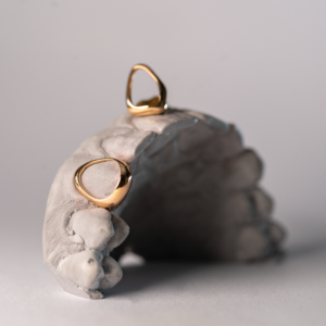 Aanbetaling afspraak afbeelding - Window Grillz Goud - Goldhead Jewelry