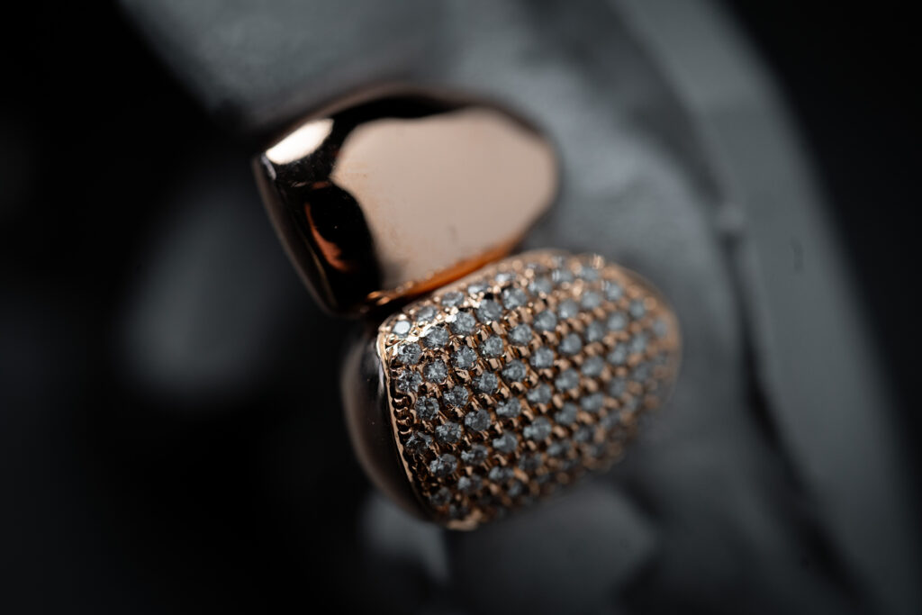 Custom two piece Grillz in roségoud met VVS