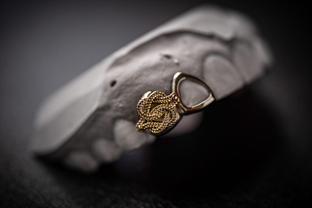 Custom two piece Grillz met mattenklopper design in goud